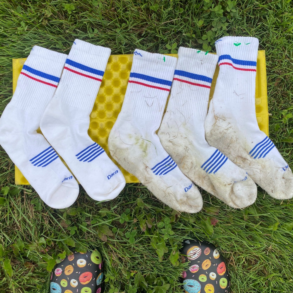 A line of dirty socks ready to get their stains removed